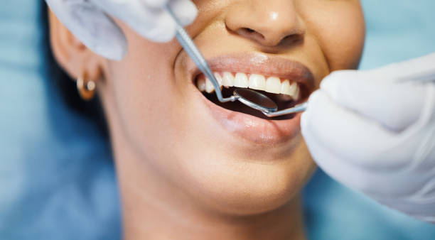 Best Emergency Treatment for Dental Infections or Abscesses in La Selva Beach, CA